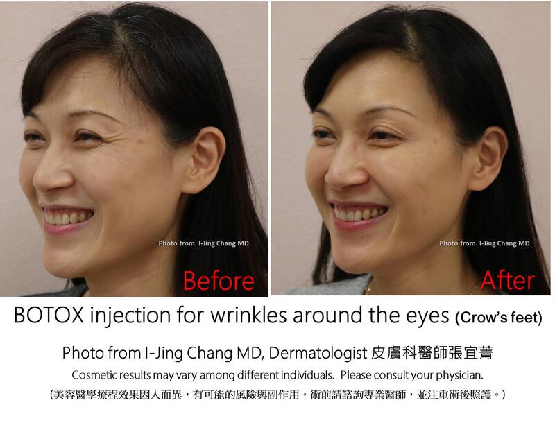 injection before and after