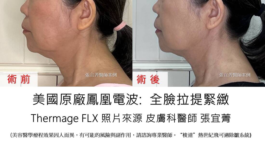 俐落輪廓線 鳳凰電波